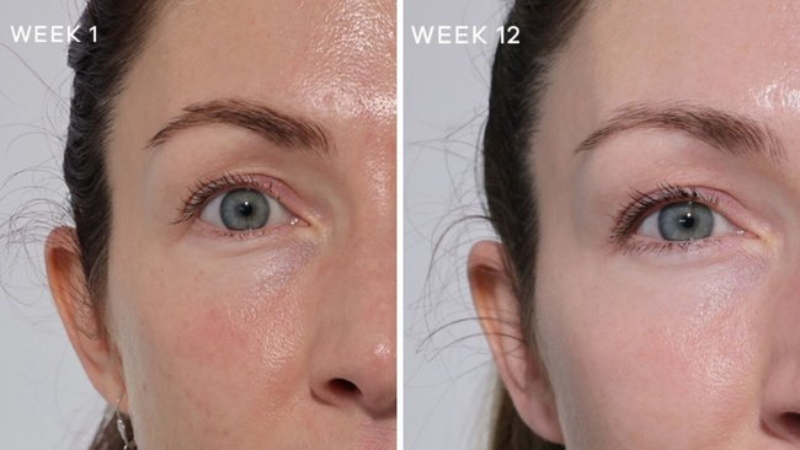 Tác dụng của bộ đôi collagen và biotin khi kết hợp 2 Tác động tích cực sau 12 tuần