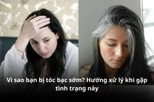 toc bac som