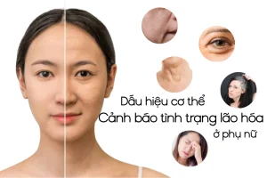 dau hieu lao hoa o phu nu
