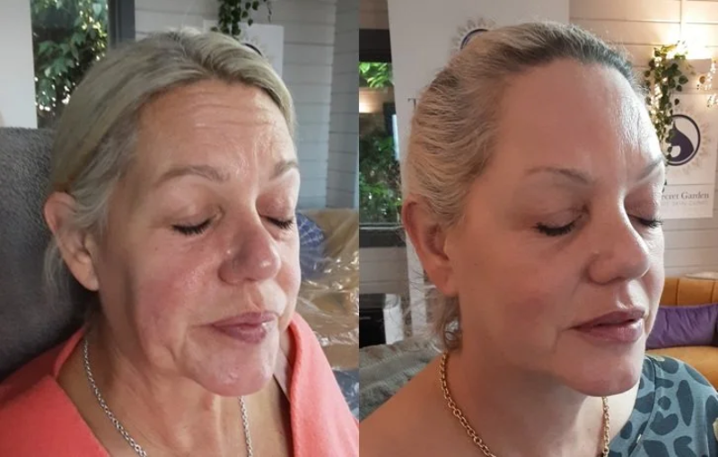 Lão hóa với phụ nữ tiền mãn kinh
