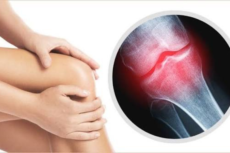 Collagen cũng giúp củng cố sức khỏe xương khớp