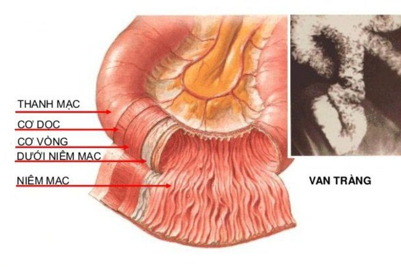 Niêm mạc ruột là cơ quan hấp thụ dinh dưỡng