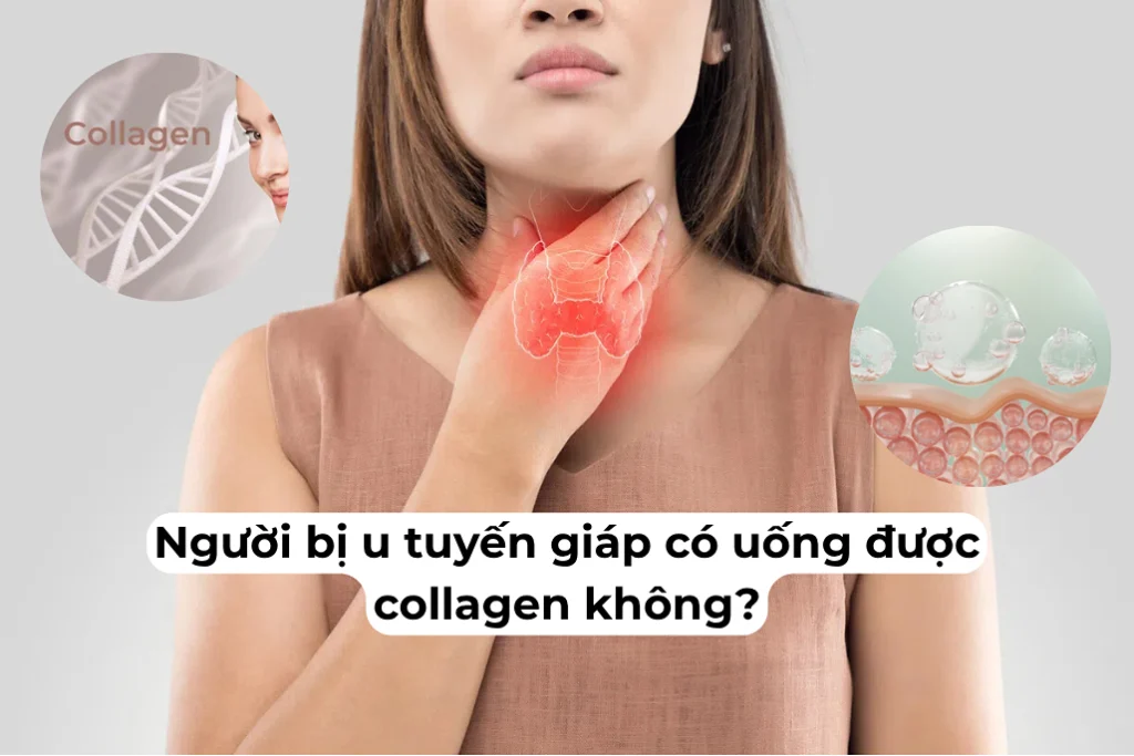 nguoi bi u tuyen giap co uong duoc collagen khong
