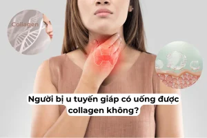 nguoi bi u tuyen giap co uong duoc collagen khong