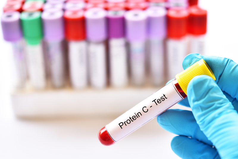 Tuổi sinh học là gì và khác biệt gì với tuổi thời gian 8 Phân tích các protein có trong máu